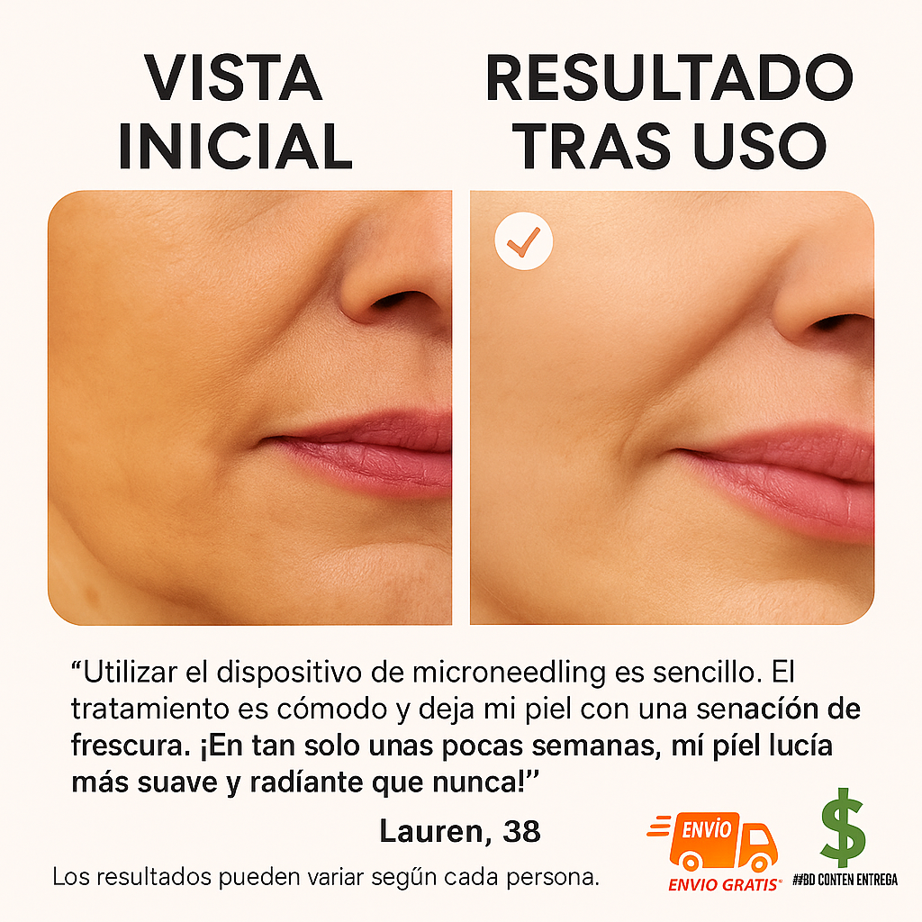 DERMAPEN+ CARGADOR+2 CARTUCHOS DE 12 AGUJAS