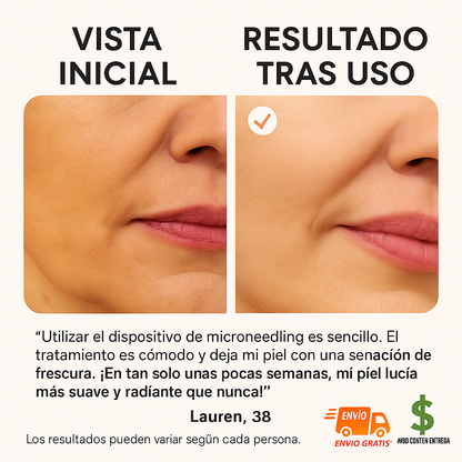 DERMAPEN+ CARGADOR+2 CARTUCHOS DE 12 AGUJAS